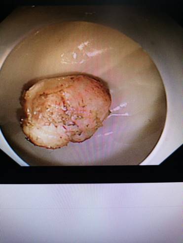 eaeaa8a5a31ae9e0b81fcf1e6459645