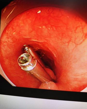 987844cdbdd8794a509bd174c94336e